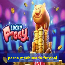 perna machucada futebol